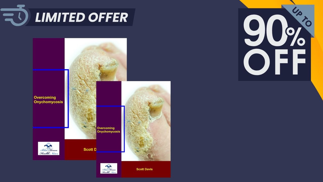 Overcoming Onychomycosis Review