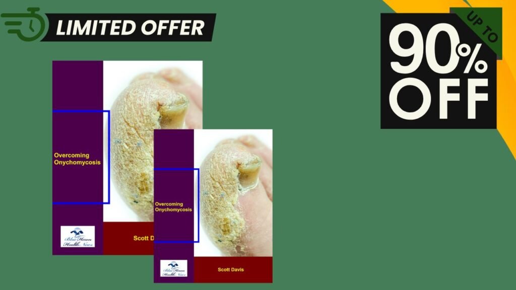 Overcoming Onychomycosis