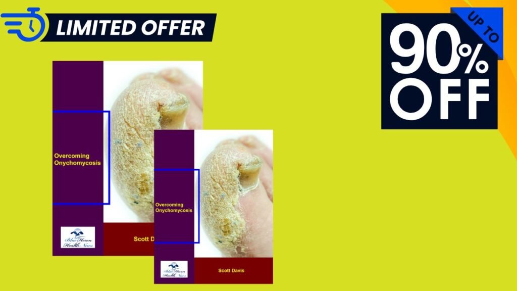 Onychomycosis Review 2025