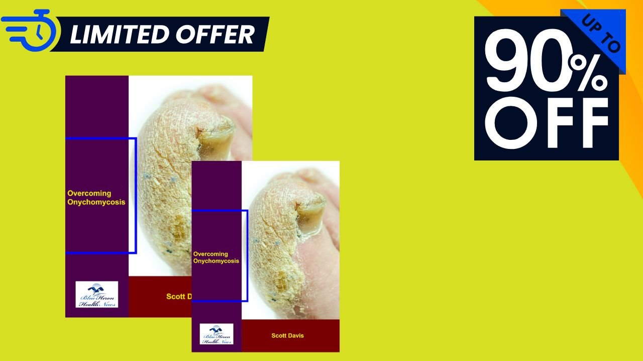 Onychomycosis Review 2025